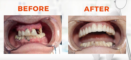 Oral Rehabilitation image